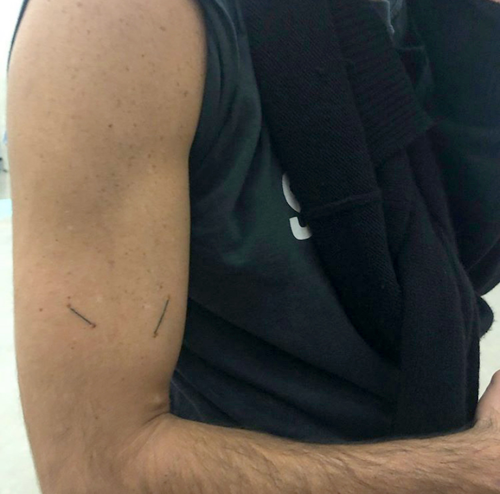 Claude Closky, ‘Tattoo lines linking one of your beauty spots to another,’ 1992-2019, tattoo, dimensions variable. 
